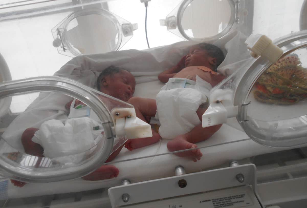I gemelli subito dopo la nascita, assistiti in un'unità neonatale