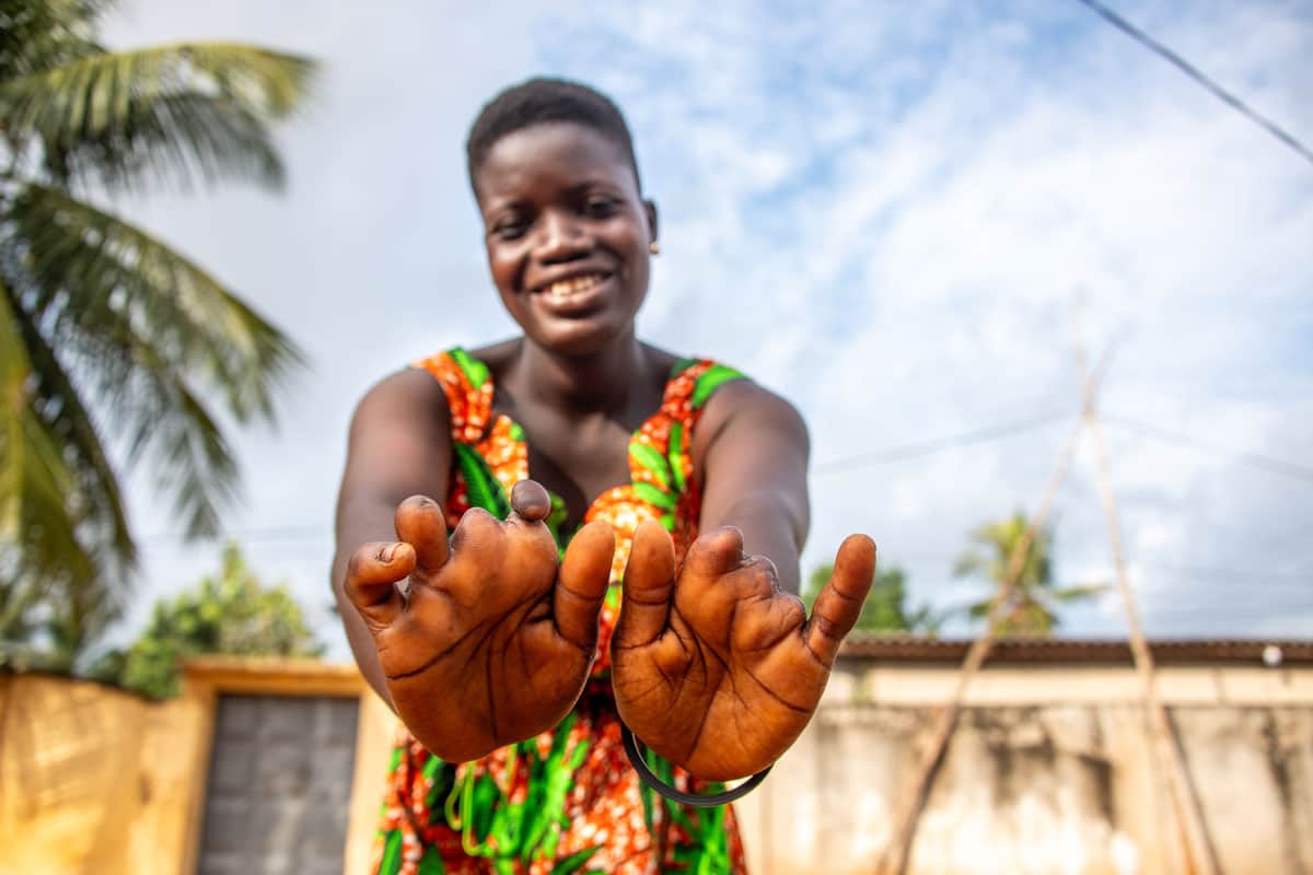 Una giovane donna del Togo con disabilità alle mani, sostenuta da Compassion